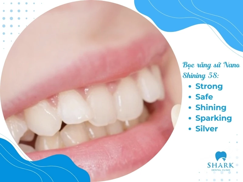 Bọc răng sứ Nano Shining 5S là gì? Loại sứ này có tốt không? 9 Điểm đặc trưng của phương pháp này nằm ở hệ tiêu chuẩn 5S tạo nên chất lượng vượt trội