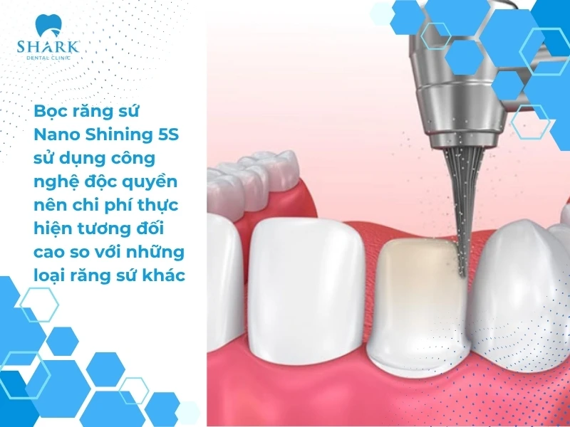 Bọc răng sứ Nano Shining 5S là gì? Loại sứ này có tốt không? 11 Sử dụng công nghệ độc quyền nên chi phí thực hiện tương đối cao so với những loại răng sứ khác