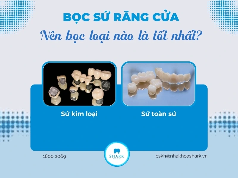Lựa chọn răng sứ toàn sứ cho vị trí răng cửa là lựa chọn sáng suốt nhất