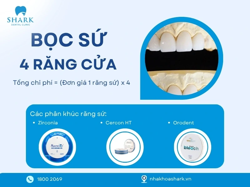 Giá bọc sứ tùy thuộc vào phân khúc loại sứ mà khách hàng chọn