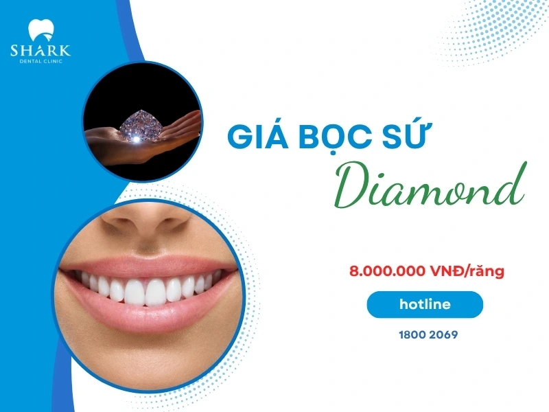 Giá bọc răng sứ Diamond thường cao hơn các loại sứ thông thường khác