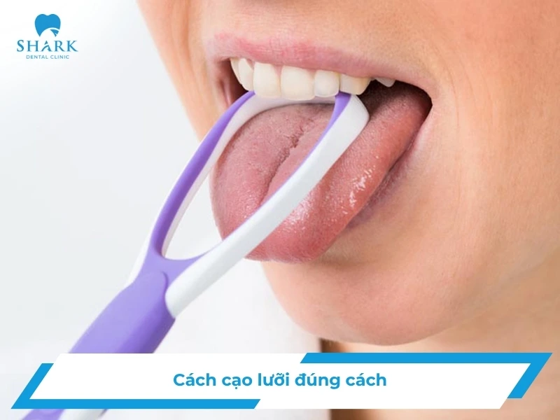Cạo lưỡi đúng cách