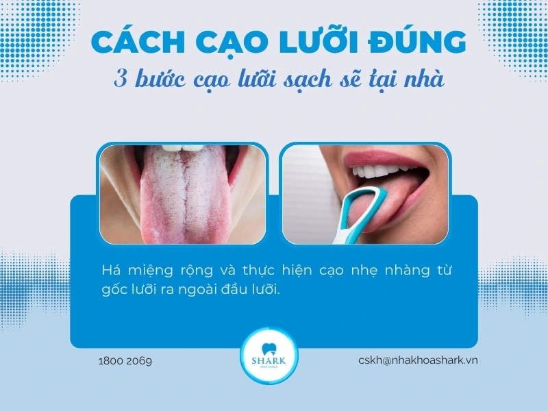 Cạo lưỡi từ trong ra ngoài nhẹ nhàng