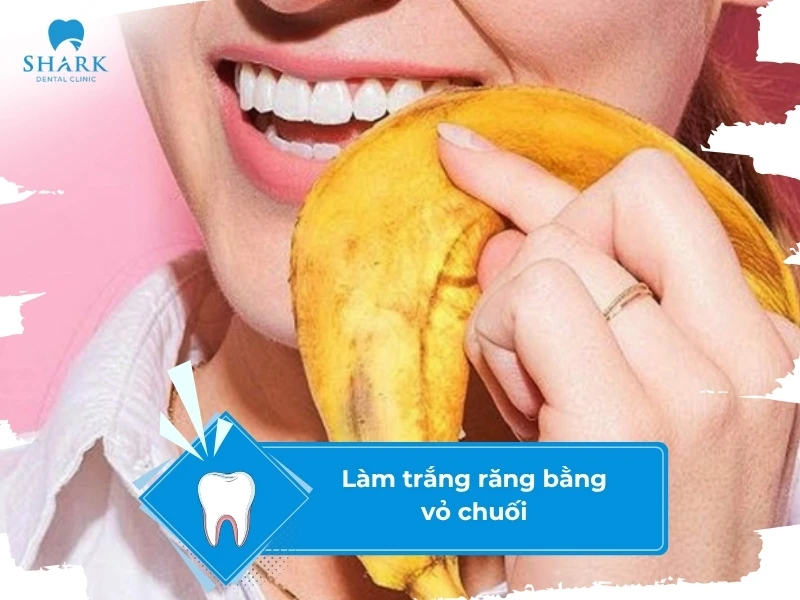 10 Mẹo làm trắng răng trong 5 phút tại nhà hiệu quả và an toàn 26 Chà răng với vỏ chuối là cách làm trắng răng đơn giản