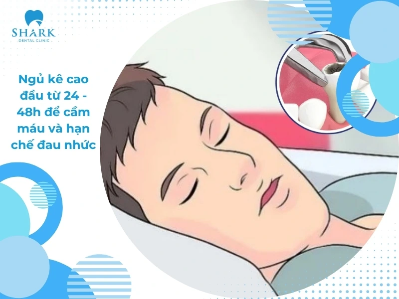 Mẹo cầm máu sau khi nhổ răng khôn đúng cách và an toàn 13 Ngủ kê cao đầu để cầm máu và hạn chế đau nhức sau khi nhổ răng khôn