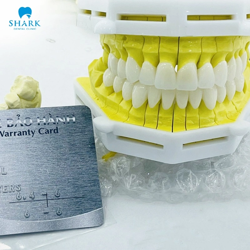 Trụ Implant tại Nha khoa Shark đảm bảo chính hãng và có bảo hành