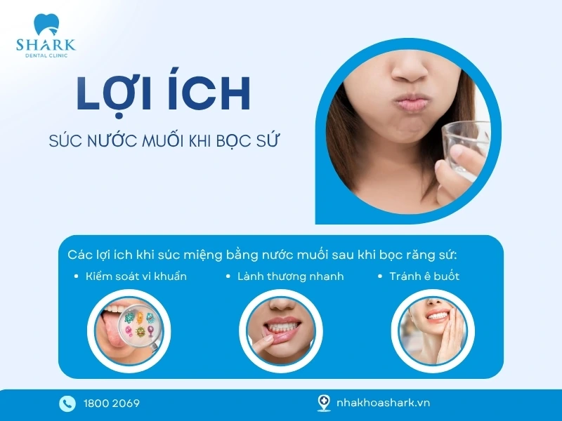 Nước muối súc miệng mang lại nhiều lợi ích thiết thực cho răng sứ