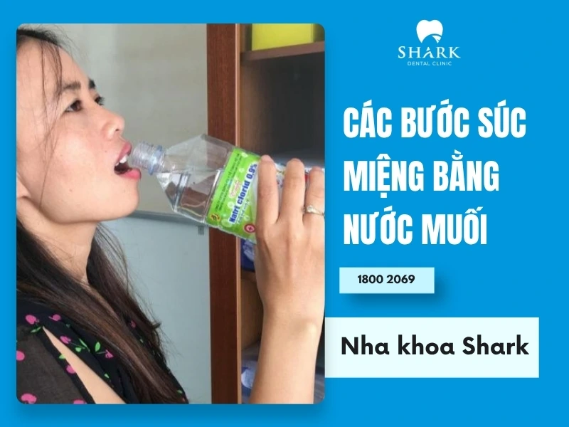 Tuân thủ đúng các bước súc miệng với nước muối để đảm bảo an toàn cho sức khỏe răng miệng