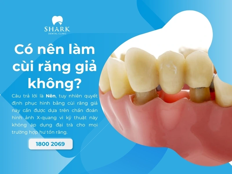 Có nên làm cùi răng giả không
