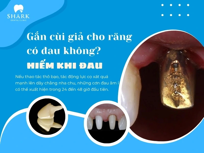 Làm cùi răng giả hiếm khi gây đau
