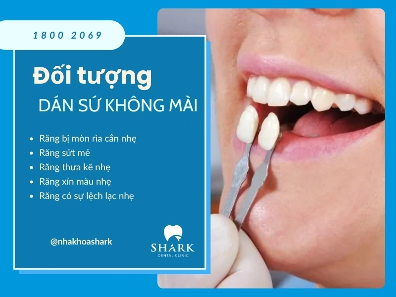 Người có tình trạng răng xỉn màu, mẻ, lệch lạc nhẹ thì mới nên dán sứ không mài