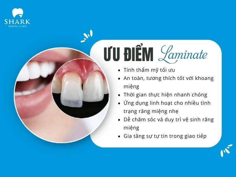 Dán răng sứ Laminate là gì? Giá dán Laminate bao nhiêu tiền? 10 Dán Laminate giúp đảm bảo tính thẩm mỹ tối ưu