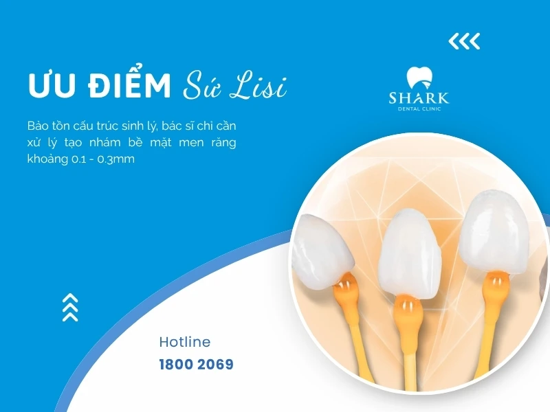 Mặt dán sứ Veneer Lisi giúp bảo tồn răng thật tối đa