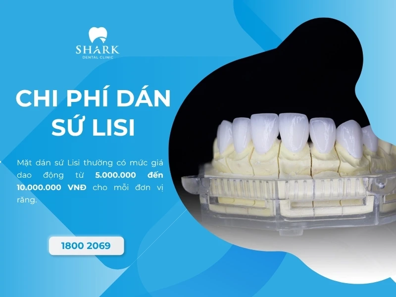 Giá dán sứ Lisi nằm ở phân khúc cao cấp