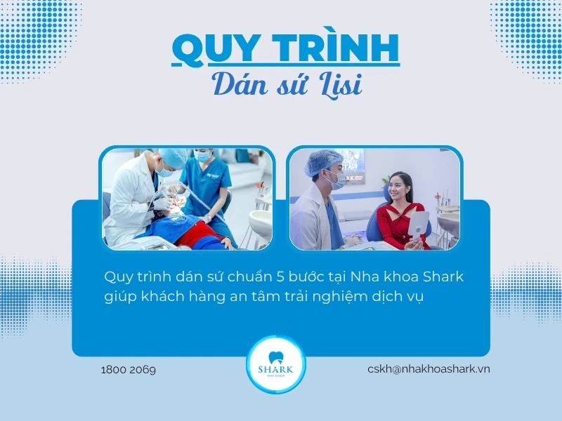Quy trình dán Lisi cần đáp ứng đầy đủ tiêu chí y khoa an toàn