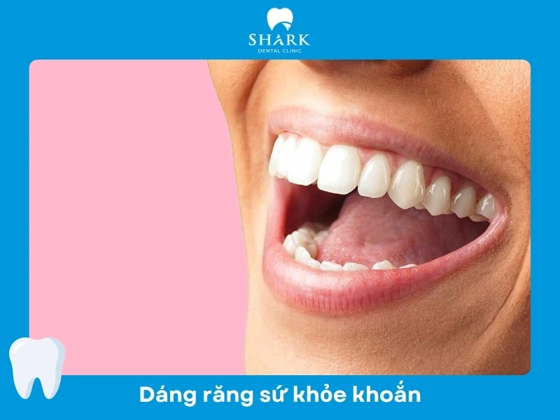 Dáng răng Sporty
