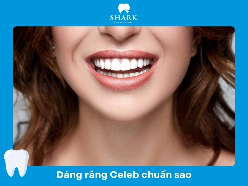 Dáng răng sứ của người nổi tiếng