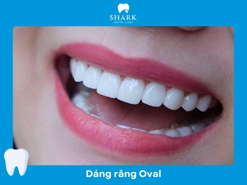 Dáng răng sứ Oval