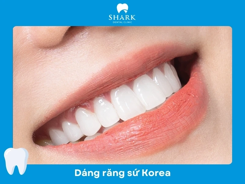 Răng sứ Korea