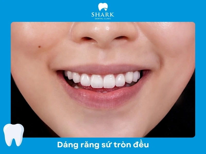 Răng sứ form tròn đều