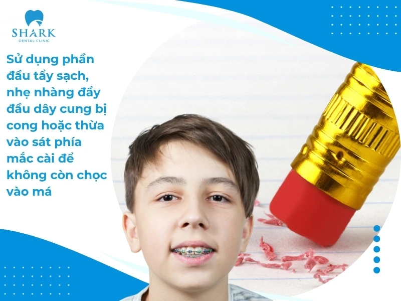 Sử dụng đầu bút chì để điều chỉnh lại dây cung