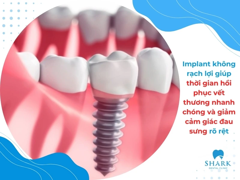 Kỹ thuật này giúp thời gian hồi phục vết thương nhanh chóng và giảm cảm giác đau sưng rõ rệt