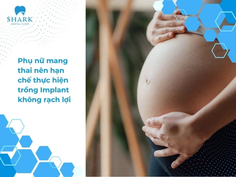 Phụ nữ mang thai nên hạn chế thực hiện trồng Implant không rạch lợi