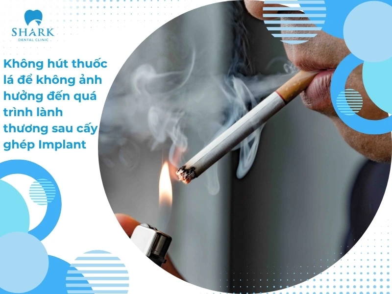 Nên hạn chế hút thuốc lá hay sử dụng rượu bia để không ảnh hưởng đến quá trình lành thương sau cấy ghép