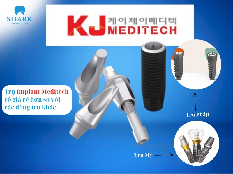 Trụ được làm từ Titanium nguyên chất có khả năng chịu lực tốt và đặc biệt là tương thích sinh học cao