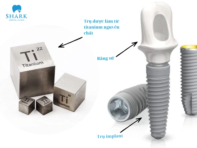 Dòng trụ Implant Meditech có mức giá khá mềm so với nhiều dòng trụ Implant khác