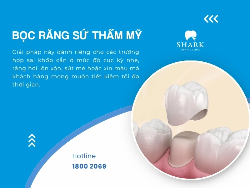 Bọc răng sứ cho răng sai khớp cắn