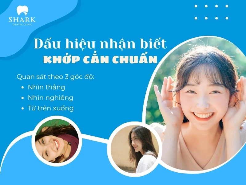 Dấu hiệu nhận biết bạn đang có một khớp cắn đúng