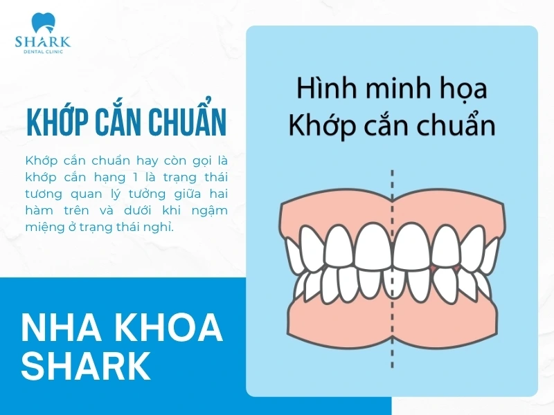 Khớp cắn chuẩn