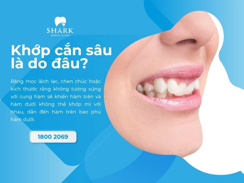 Các nguyên nhân dẫn đến tình trạng khớp cắn sâu