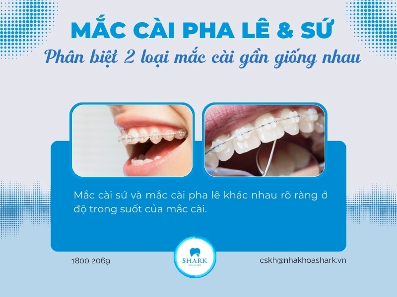 Mắc cài pha lê và sứ