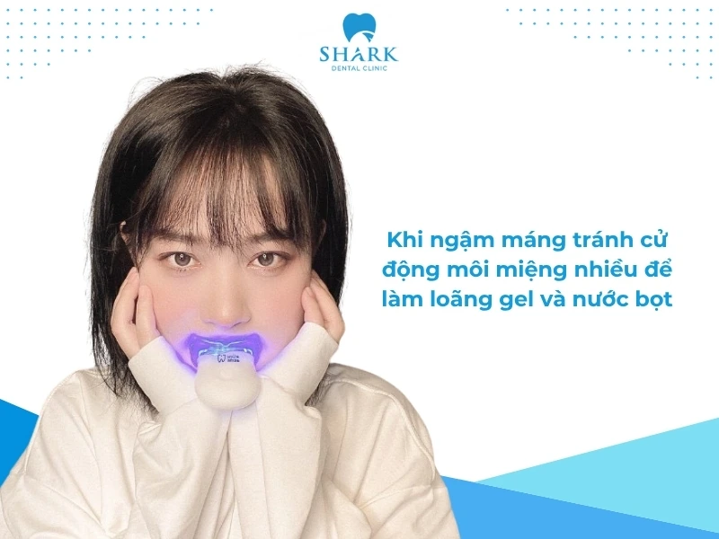 TOP 10 máy làm trắng răng tại nhà tốt và an toàn năm 2026 28 Hạn chế cử động miệng khi sử dụng máy tẩy răng