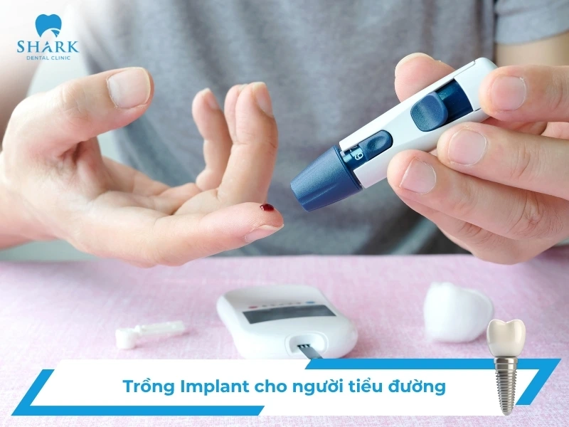 Người tiểu đường có trồng răng Implant được không? Vì sao? 14 Người tiểu đường có trồng răng Implant được không