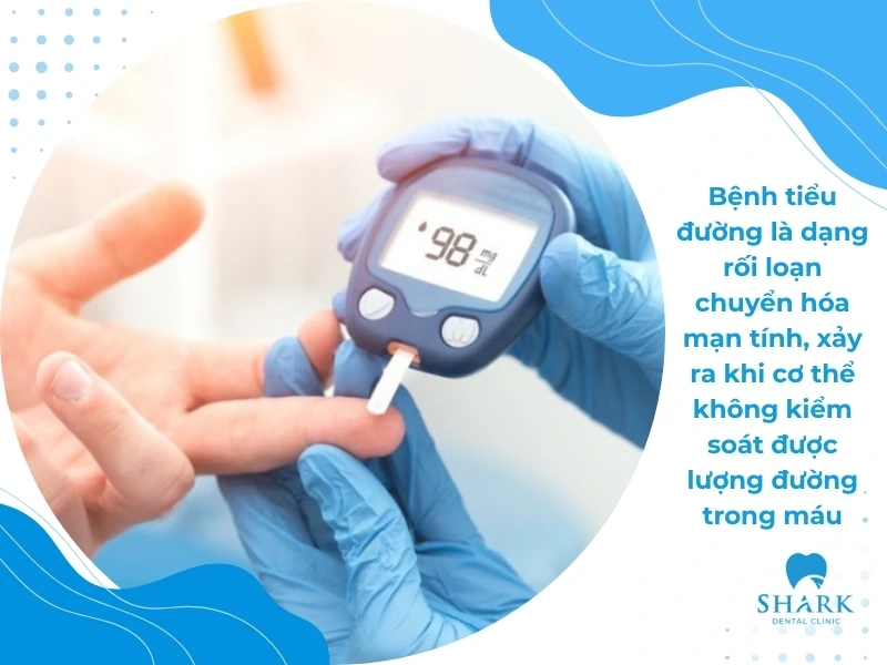 Người tiểu đường có trồng răng Implant được không? Vì sao? 11 Bệnh tiểu đường là dạng rối loạn chuyển hóa mạn tính, xảy ra khi cơ thể không kiểm soát được lượng đường trong máu, khiến đường huyết luôn ở mức cao