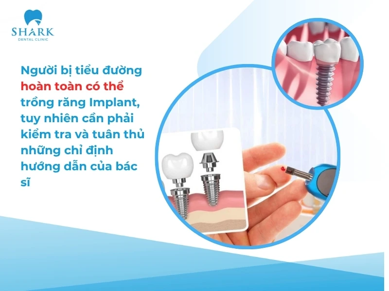 Người tiểu đường có trồng răng Implant được không? Vì sao? 12 Người bị tiểu đường hoàn toàn có thể trồng răng Implant, tuy nhiên cần phải kiểm tra và tuân thủ những chỉ định hướng dẫn của bác sĩ