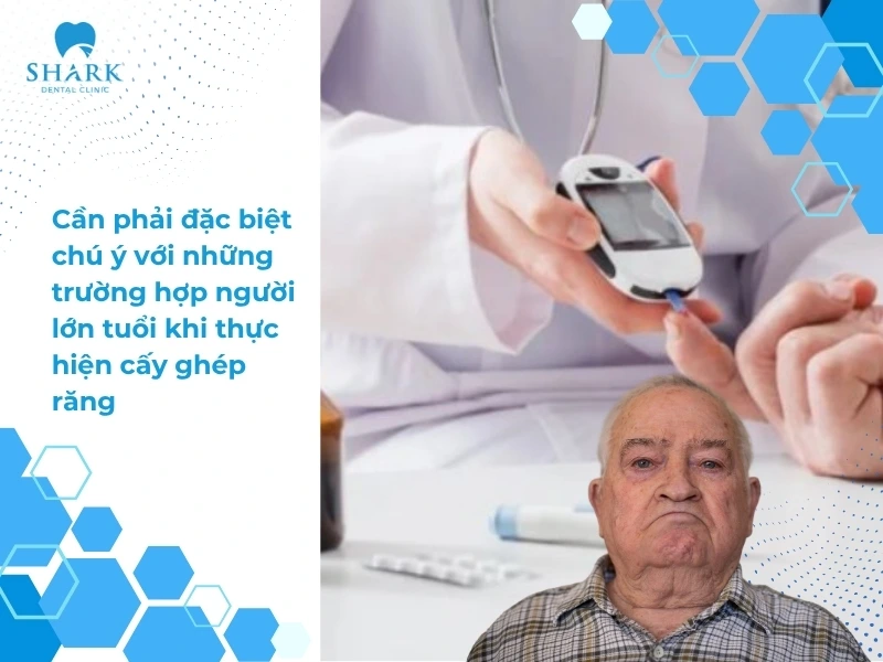 Người tiểu đường có trồng răng Implant được không? Vì sao? 14 Cần phải đặc biệt chú ý với những trường hợp người lớn tuổi khi thực hiện cấy ghép răng