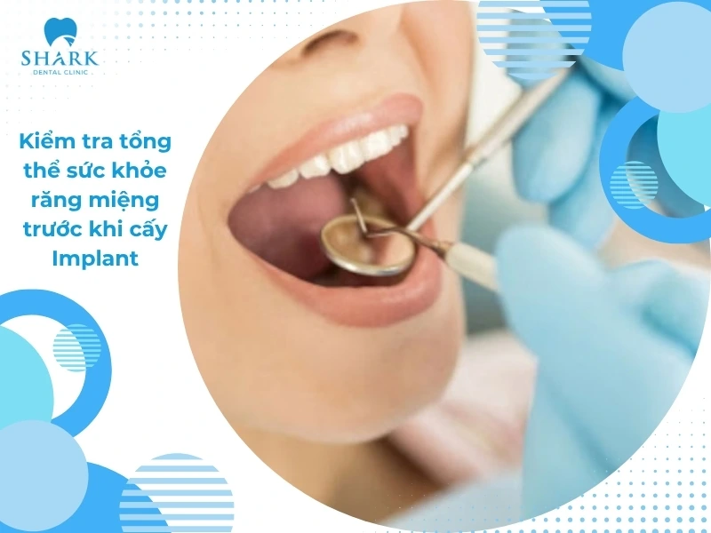 Người tiểu đường có trồng răng Implant được không? Vì sao? 15 Trước khi thực hiện, bác sĩ sẽ kiểm tra tổng thể sức khỏe răng miệng để đảm bảo an toàn cho quá trình cấy ghép