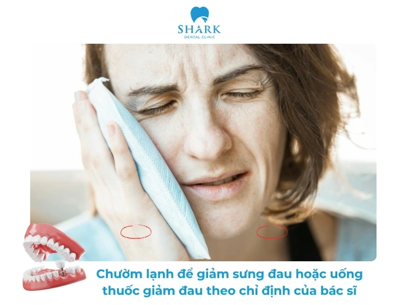 Người tiểu đường có trồng răng Implant được không? Vì sao? 18 Bạn nên chườm lạnh quanh vùng má để giảm sưng đau hoặc có thể uống thuốc giảm đau theo chỉ định của bác sĩ