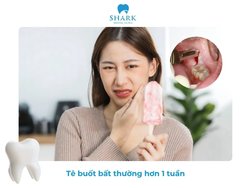 10 Dấu hiệu nhiễm trùng sau khi nhổ răng khôn và cách xử lý 25 Răng ê buốt thường xuyên