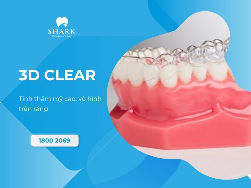 Vô hình hoàn toàn trên răng