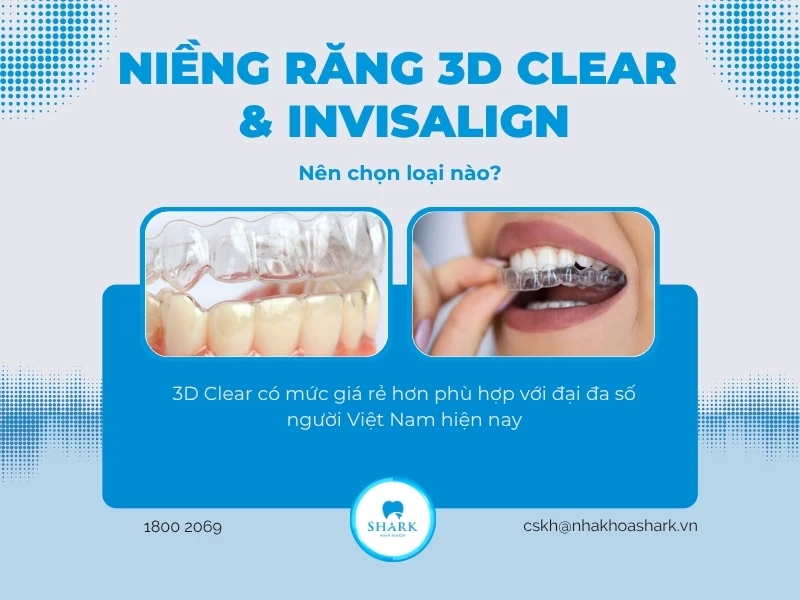 Niềng răng 3D Clear và Invisalign