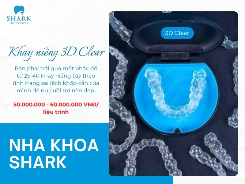 Liệu trình niềng từ 24-30 khay nên chi phí cũng sẽ chênh lệch theo số lượng khay