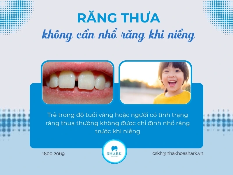 Răng thưa là tình trạng thường gặp mà bạn sẽ chỉ định không cần nhổ răng trước khi niềng