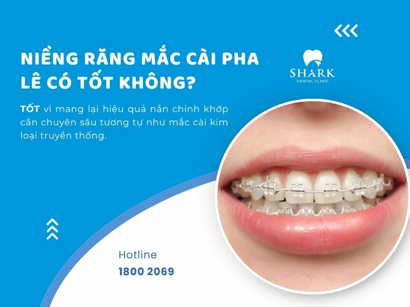 Niềng răng mắc cài pha lê mang lại hiệu quả tương tự với mắc cài kim loại