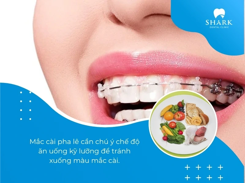 Chú ý chế độ ăn uống trước và sau khi niềng