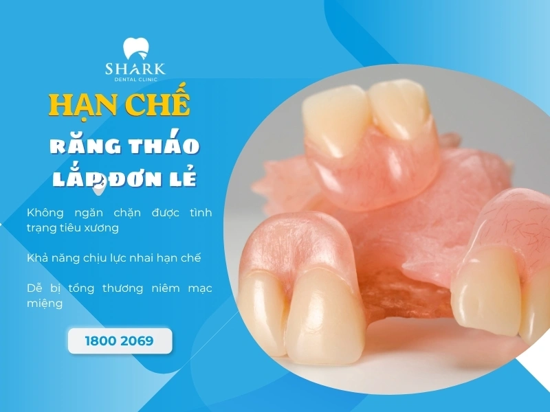 Nhược điểm khi dùng răng giả tháo lắp đơn lẻ